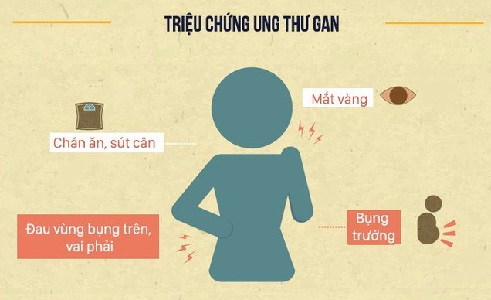 dau-hieu-ung-thu-gan