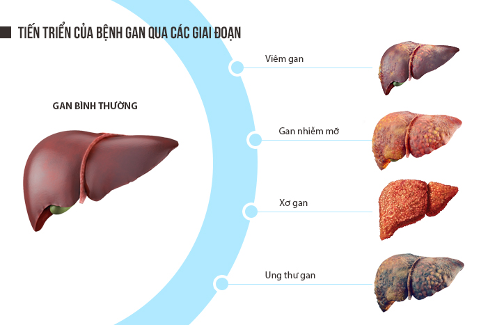 muon-neo-duong-dan-den-xo-gan-1